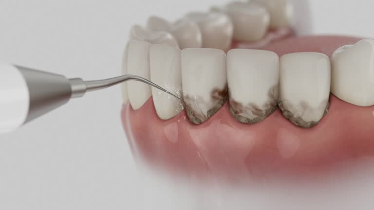 Reliable Dental Implants contractor in Claypool, AZ by Smile Center Dentistry